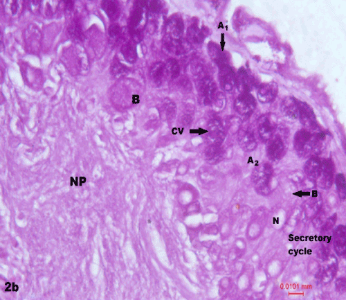 cytoplasmic