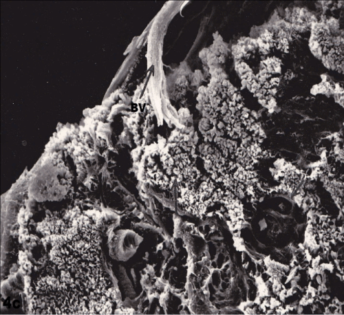cortical