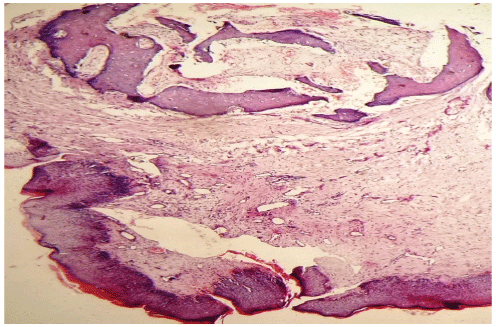 Epithelium