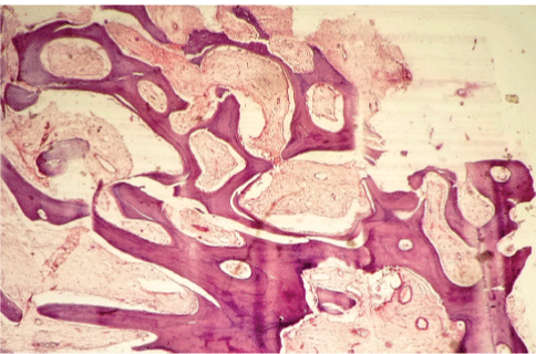 Fibrovascular