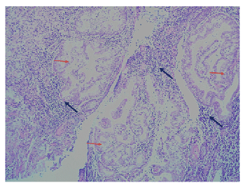 haematoxylin