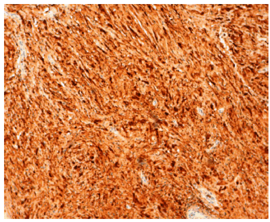 Imunohistochemical