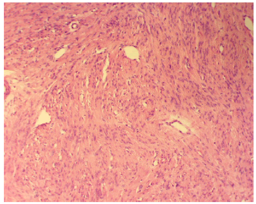 vascularized