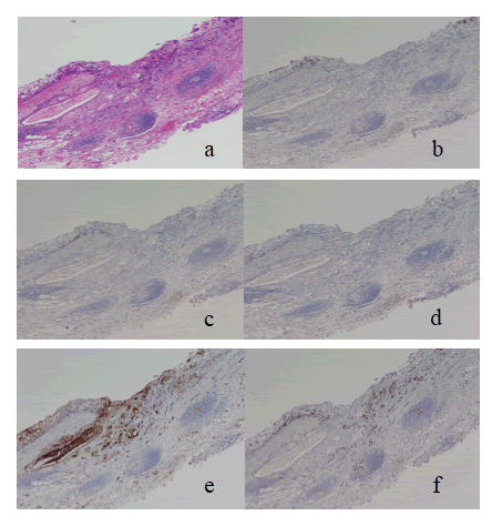 submucosal