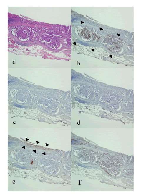 immunohistochemistry