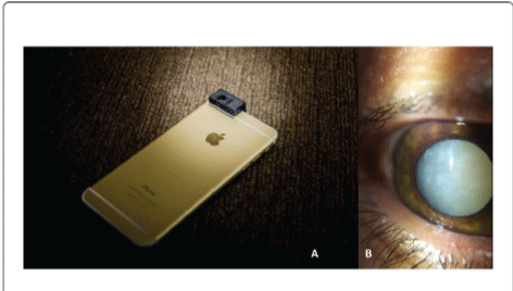 smartphone