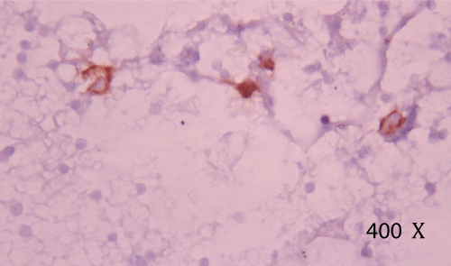 Immunocytochemical