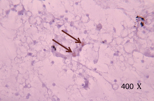 Immunocytochemical