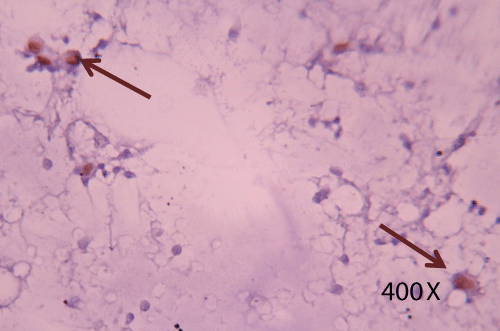 Immunocytochemical