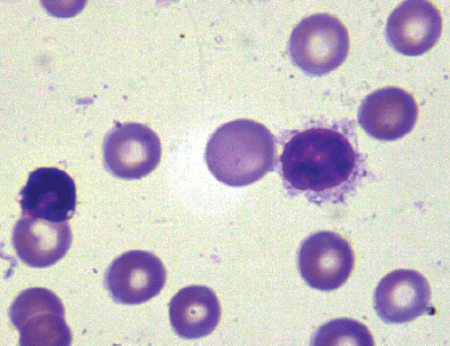 lymphoid