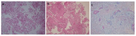 Photomicrograph
