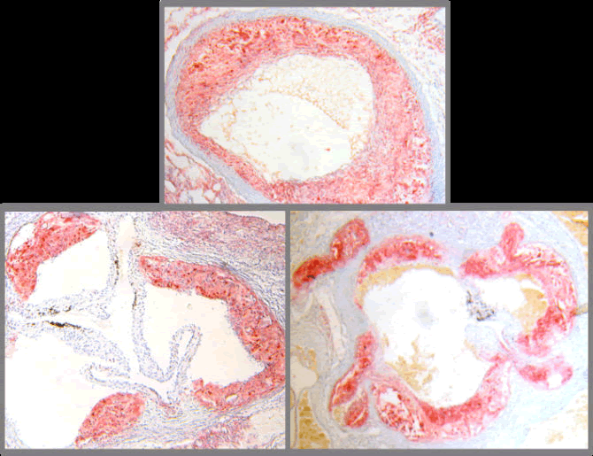 aorta