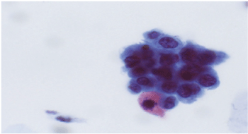 chromatin