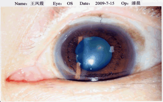 biomicroscopy