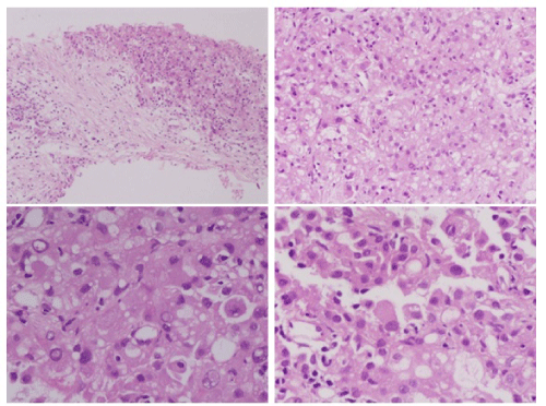 photomicrograph