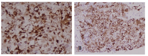 Immunohistochemistry 