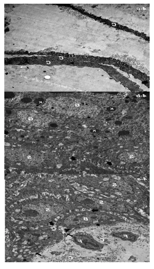 micrograph