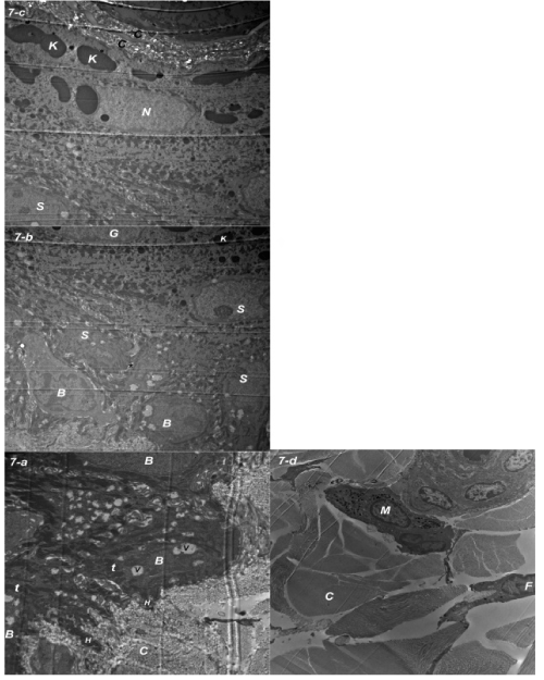 micrograph
