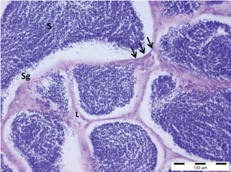 spermatogonia