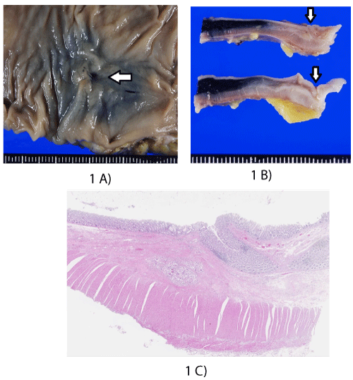 Histopathological
