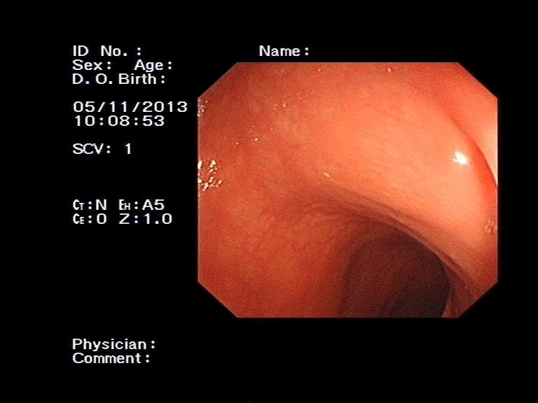 intestinal