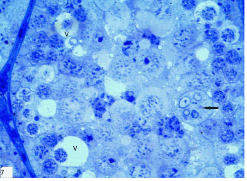 photomicrograph