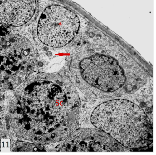photomicrograph