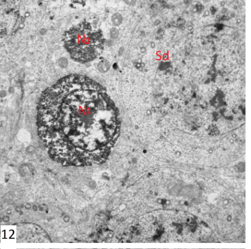 photomicrograph