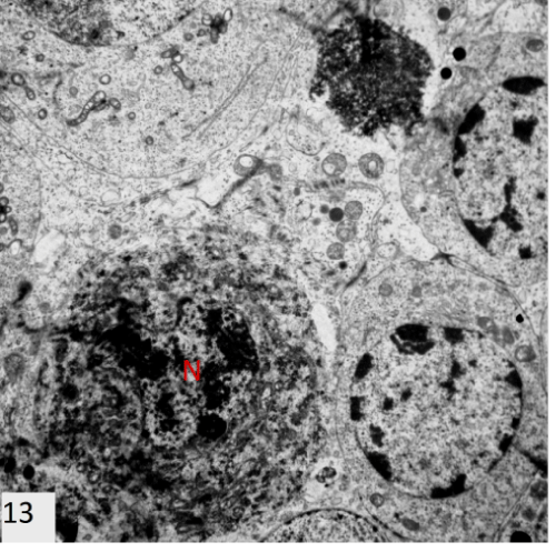 photomicrograph