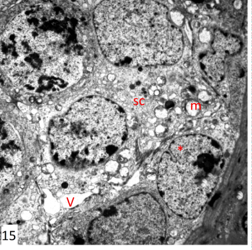 photomicrograph