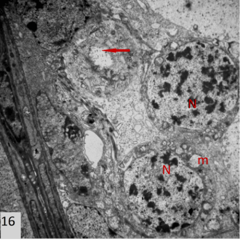 photomicrograph