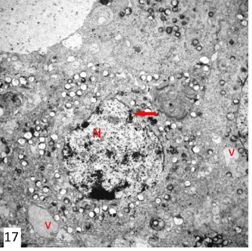 photomicrograph