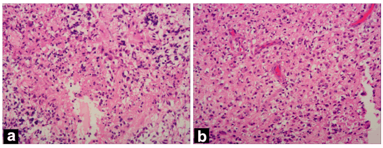 Histopathological