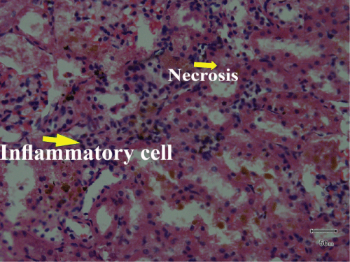 leukocyte