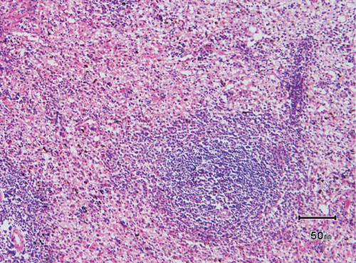 spleen