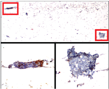 immunocytochemistry
