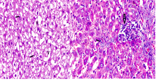 hepatocyte