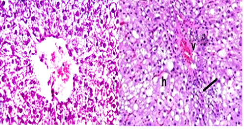hepatic
