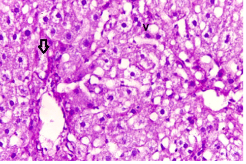 photomicrograph