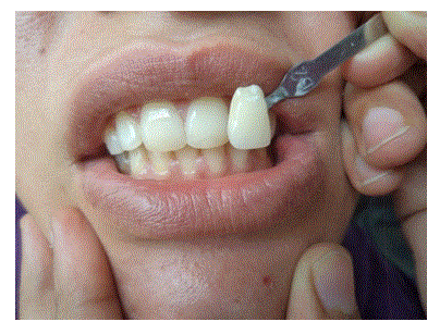 enamel color