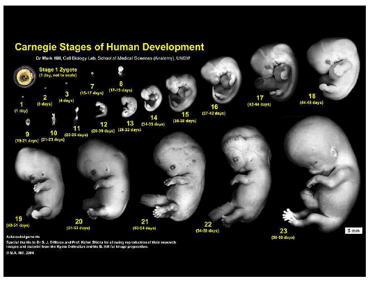 stages