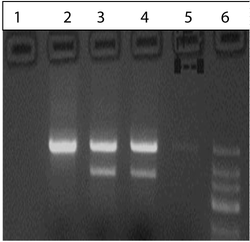 Electrophoresis