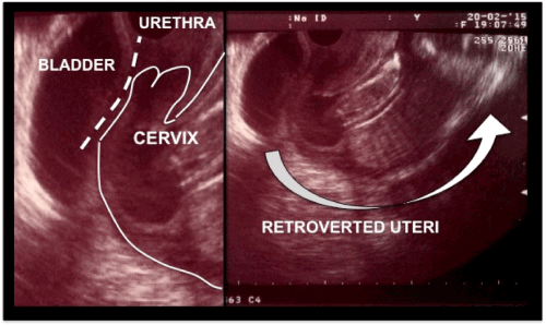 ultrasonography