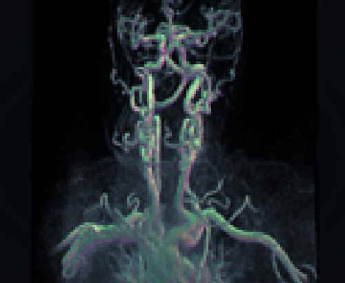 Stereoscopic