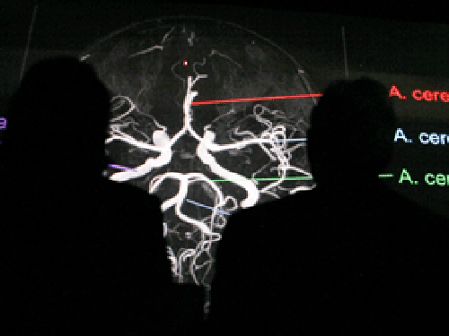 angiography