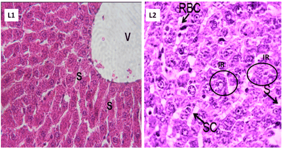 liver