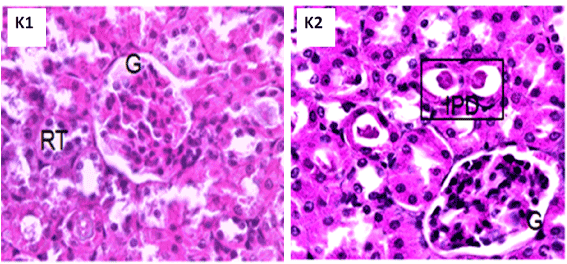 kidney
