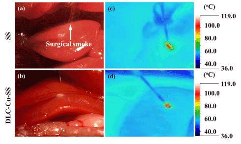 Surgical