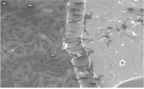 magnification
