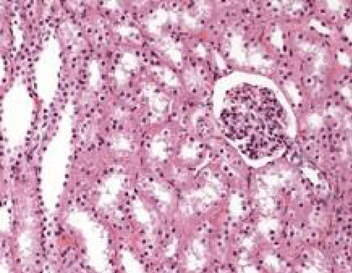 lomustine